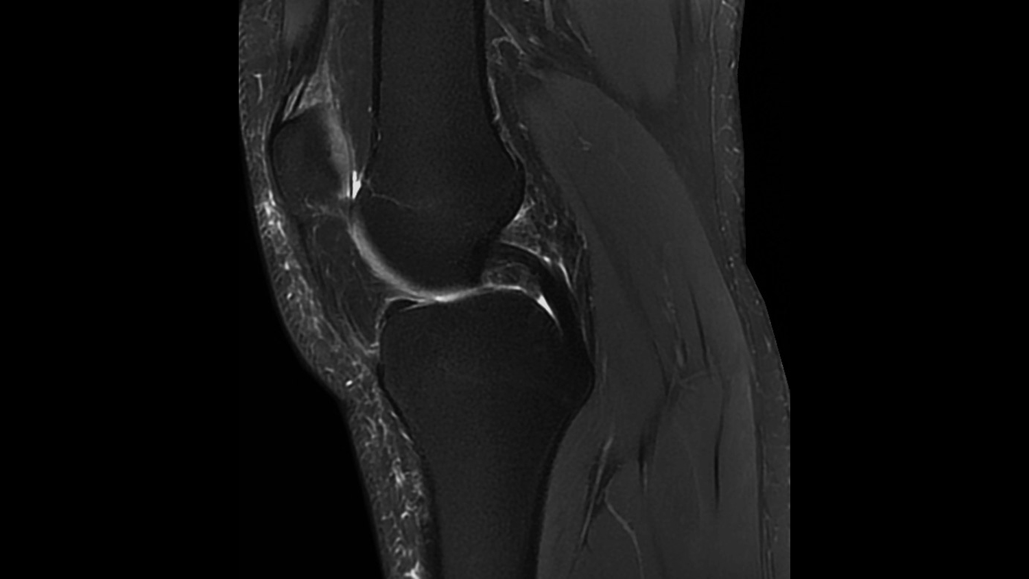 Musculoskeletal Radiology - Regional Radiology Group